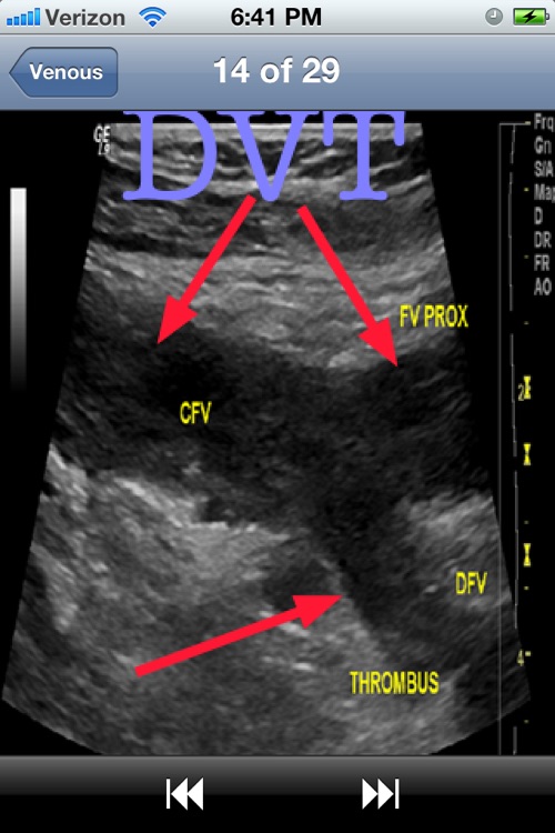 Vascular Ultrasound Pocket Reference by iSonographer