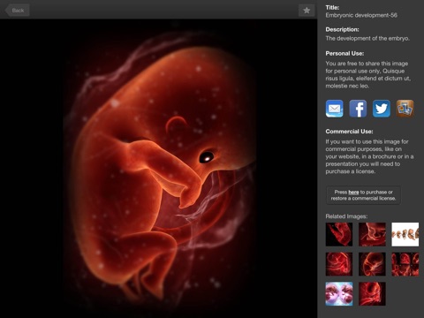 3D4Medical Images & Animations screenshot 3