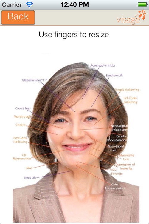 Plastic Surgery by Dr. Marc DuPéré MD, CM, FRCSC screenshot-4