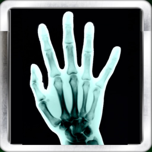 X-Ray Scan + iOS App