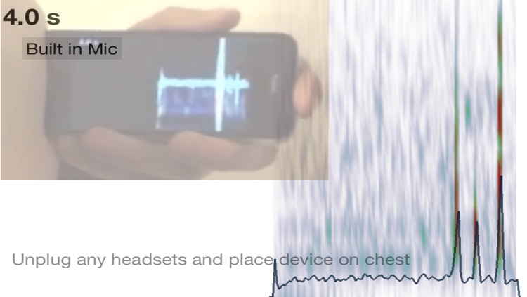 Mobile Stethoscope
