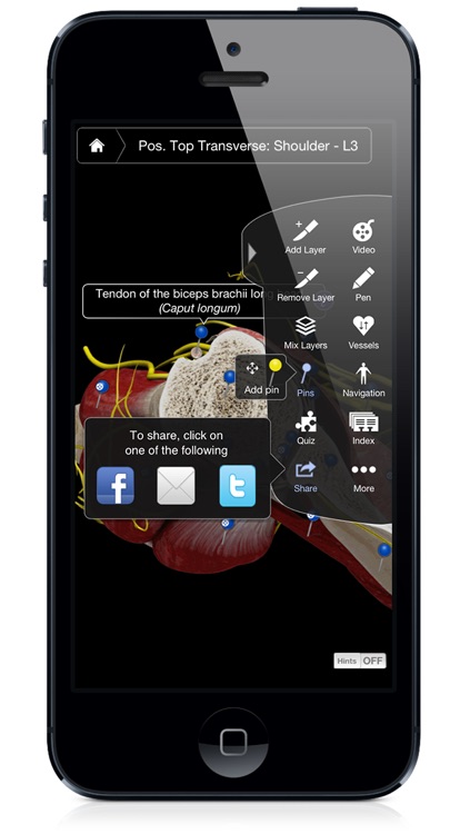Shoulder Pro III with Animations - iPhone Edition screenshot-3