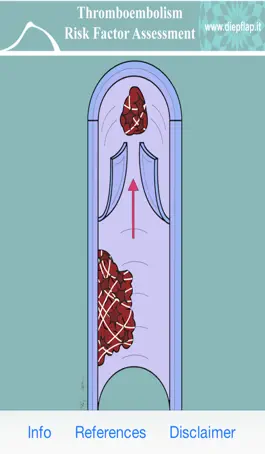 Game screenshot Thromboembolism Risk apk