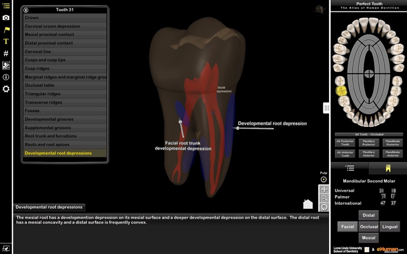 Perfect Tooth thumbnail 4