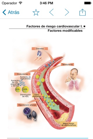 Miniatlas Acute Coronary Syndrome screenshot 4