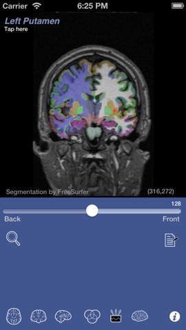 iSurf BrainViewのおすすめ画像5