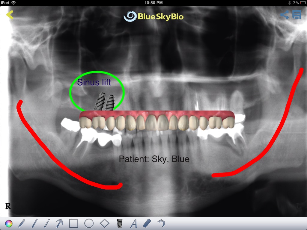 BIO View screenshot 4