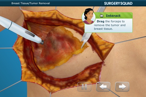 Surgery Squad's Mastectomy screenshot 4