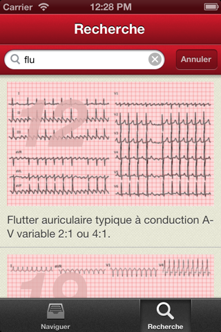 The ECG Collection screenshot 2