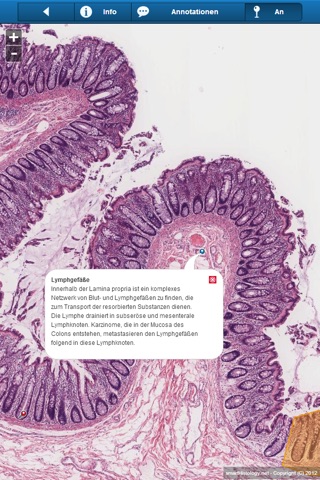 Smart Histology Lite screenshot 4