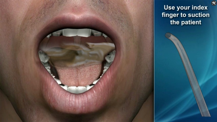 Medrills: Suctioning Airway screenshot-4