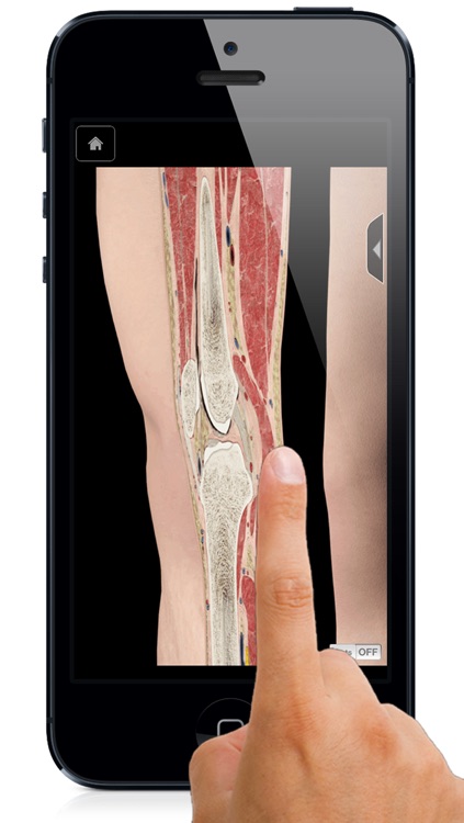 Knee Pro III with Animations - iPhone Edition