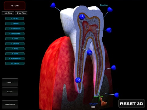 3D Tooth R screenshot 2