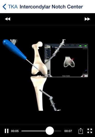 Aesculap® OrthoPilot® USA screenshot 4