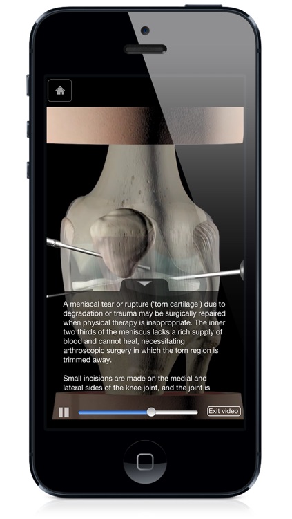 Knee Pro III with Animations - iPhone Edition screenshot-4