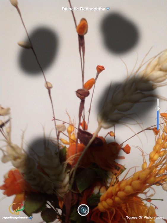 Types Of Vision Loss