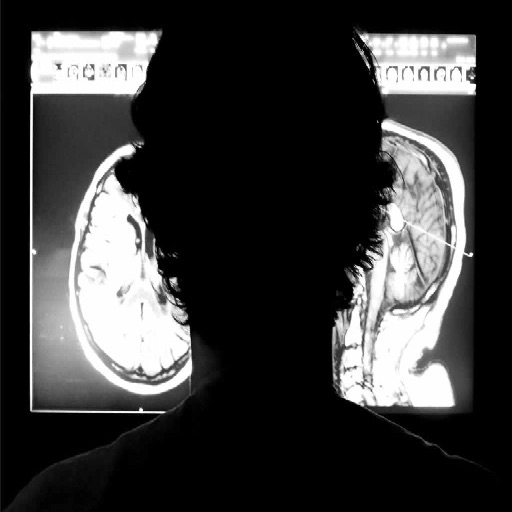Brain MRI Atlas