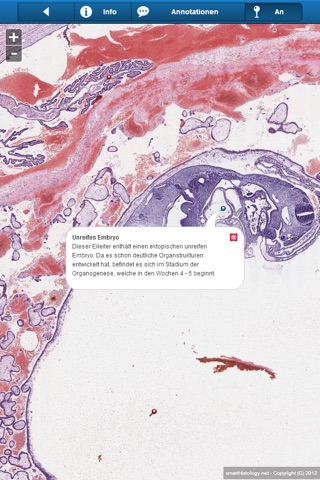 Smart Histology screenshot 3