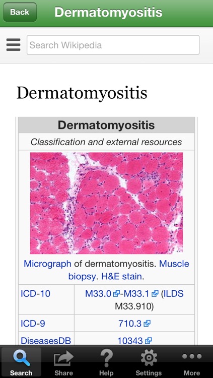 Isabel Symptom Checker screenshot-4