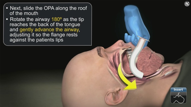 Medrills: Airway Management