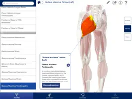 Game screenshot Rehabilitation for Lower Limbs apk