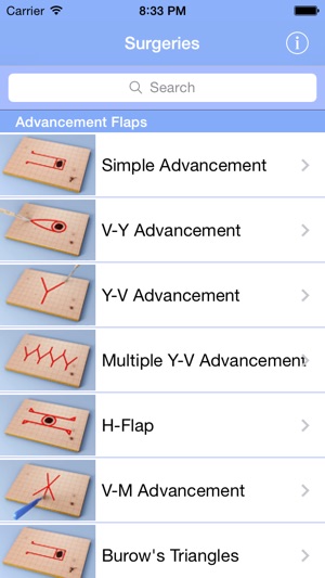 Surgical Flaps(圖1)-速報App