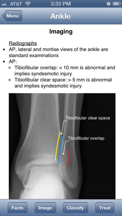 Ortho Traumapedia screenshot-4