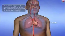 Game screenshot ArchieMD IC Health Coronary Bypass apk