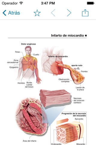 Miniatlas Acute Coronary Syndrome screenshot 3