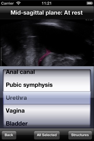 EcoAtlas Pelvic Floor screenshot 3