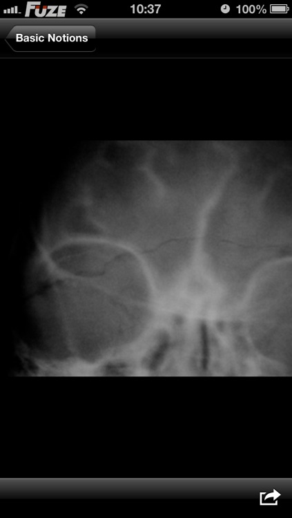 Traumatic Brain Injury (TBI) screenshot-3
