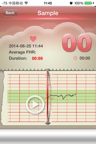 SmartFetal screenshot 3