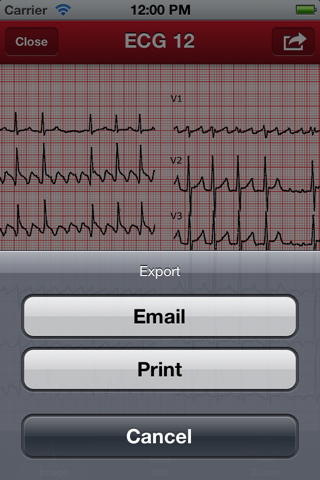 The ECG Collection screenshot 4