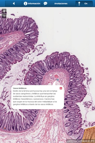 Smart Histology Lite screenshot 4