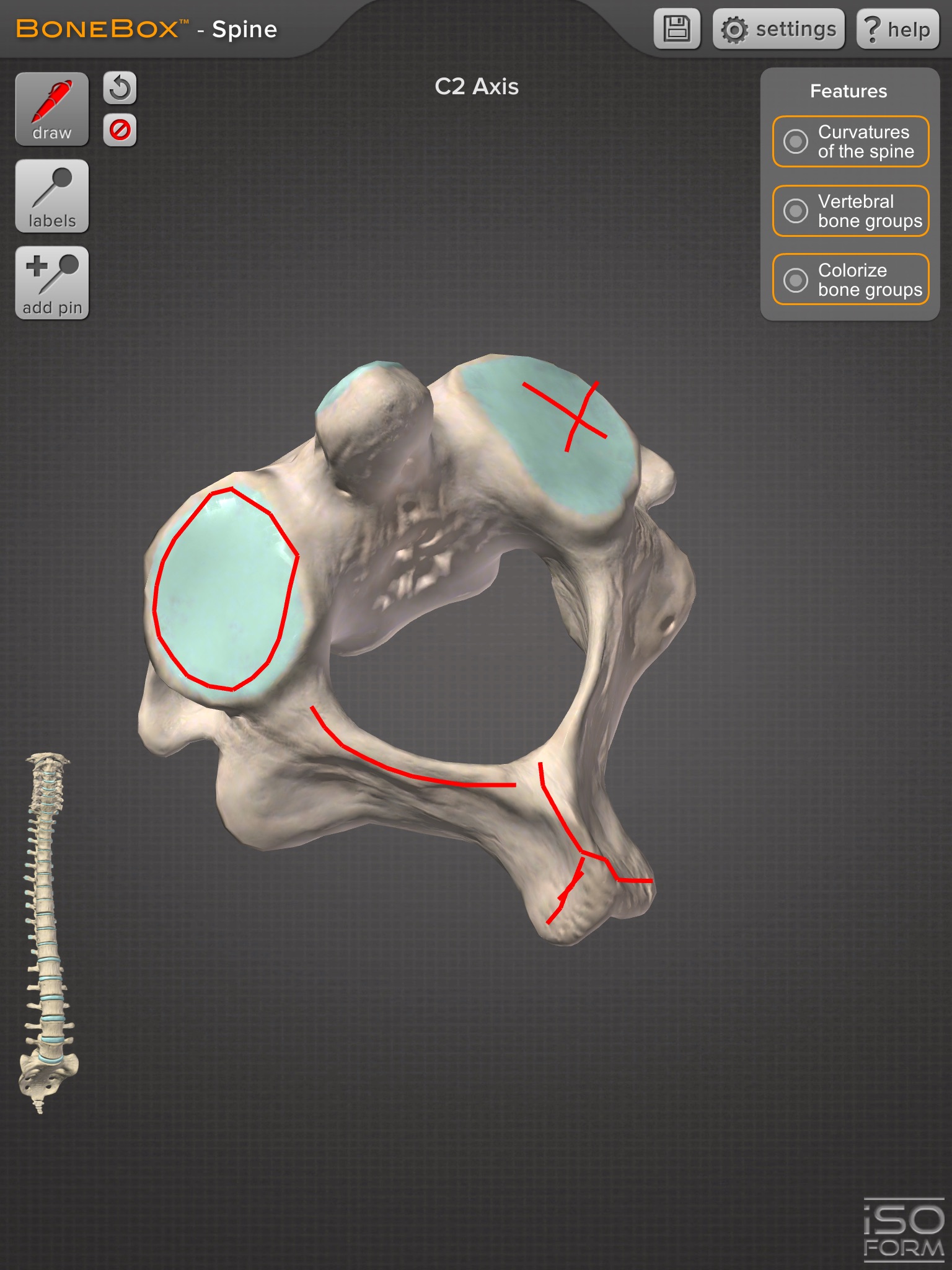 BoneBox™ - Spine Viewer screenshot 4