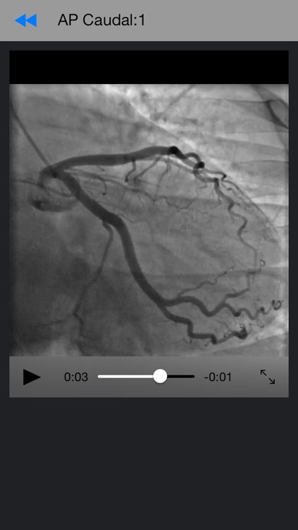 CathLab App