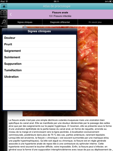 Screenshot #6 pour Atlas de proctologie