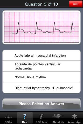 ECG Pocket Reference UK screenshot 3