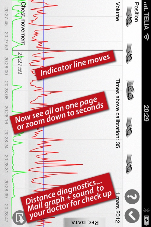 SnoreMonitorSleepLab