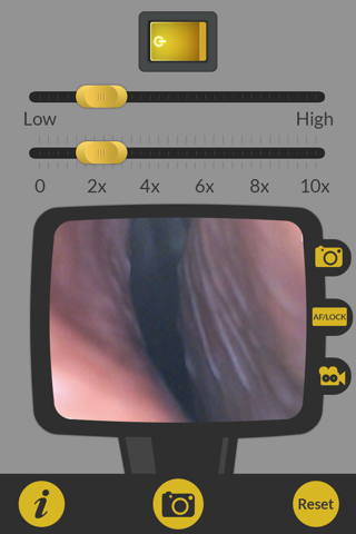 OtoscopeApp screenshot 2