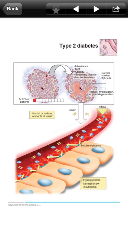 Miniatlas Diabetes Mellitus