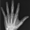 FracturED: A Fracture in the ED; Module 1: Hand and Wrist
