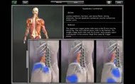 Muscle Trigger Point Anatomy iphone bilder 2