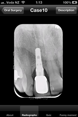 Dental Radiographs screenshot 4