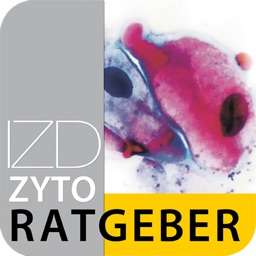 IZD Zyto Ratgeber