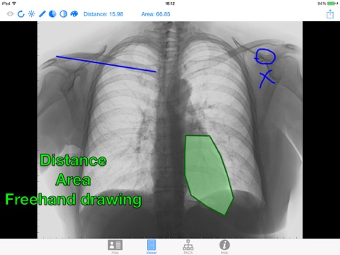 DICOM IR screenshot 3