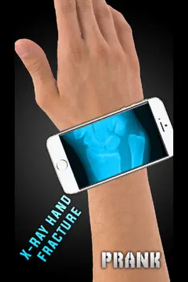 Game screenshot Simulator X-Ray Hand Fracture apk