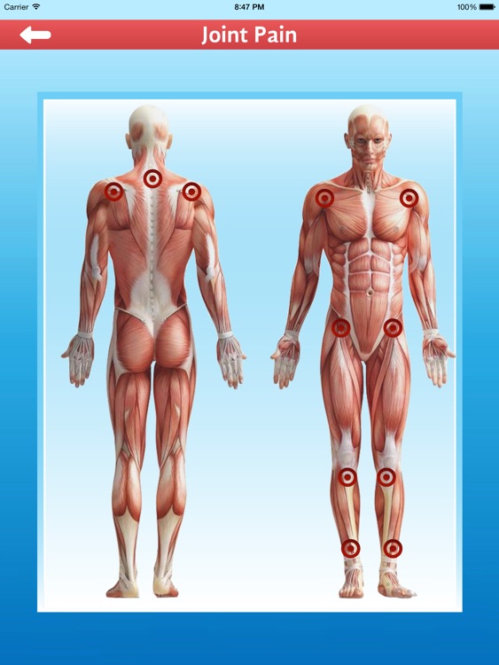 Cupping Therapy - Al Hijamah Preventive Medicine