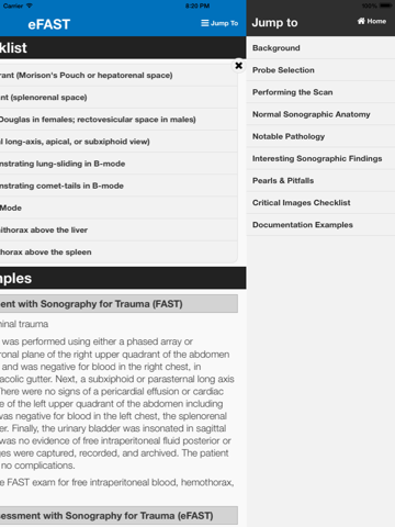 SonoSupport: a clinical emergency medicine and critical care ultrasound reference toolのおすすめ画像4