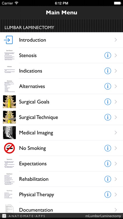 mLumbarLaminectomy